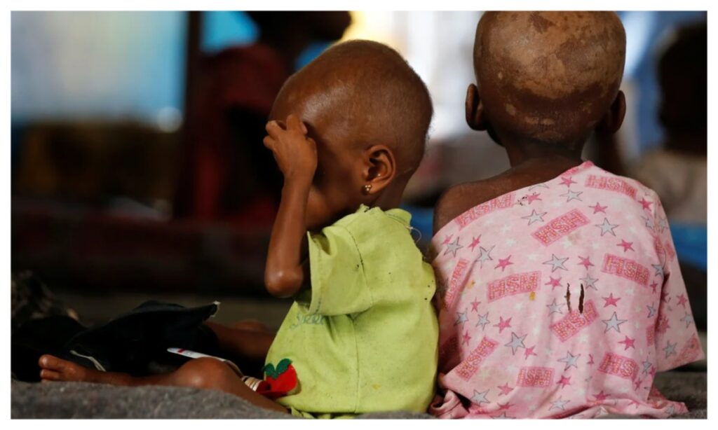 440,000 Nigerian Children Treated For Malnutrition In 2025 — MSF