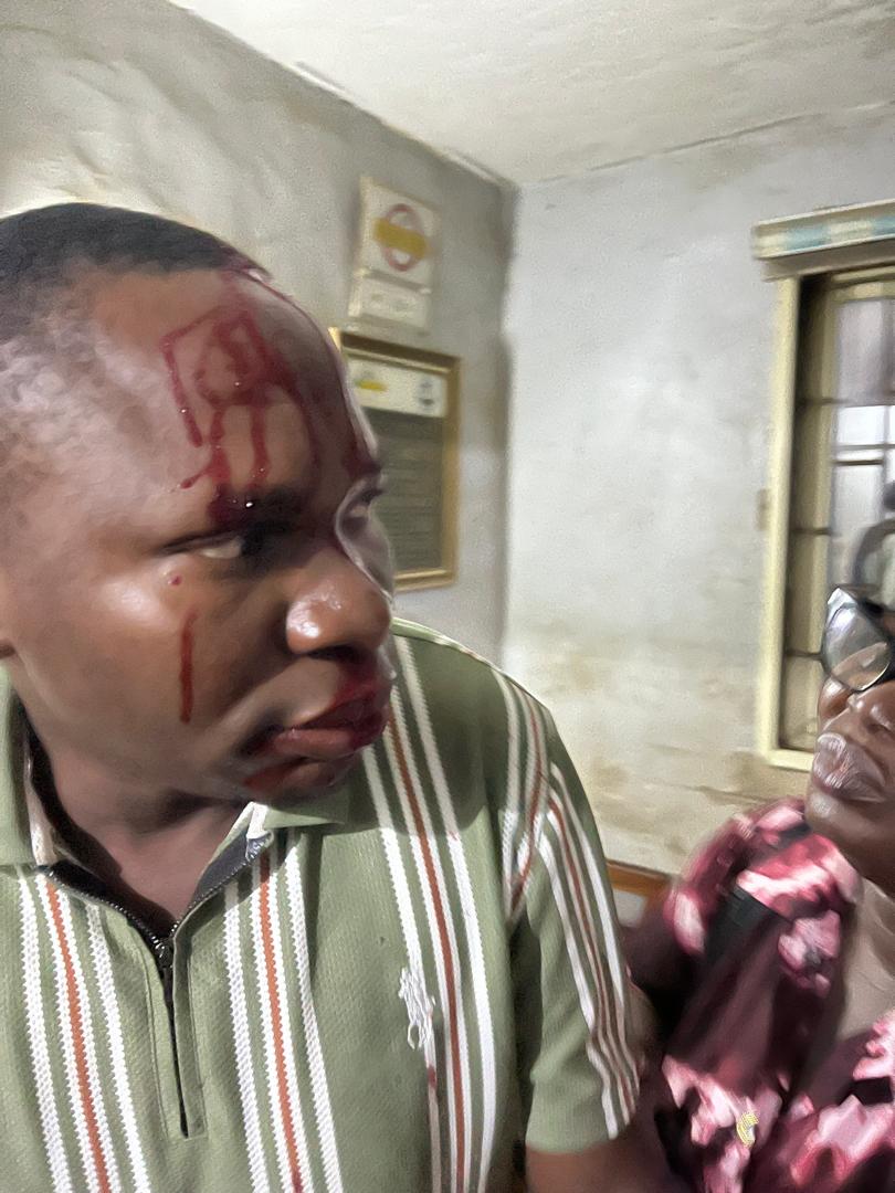 FMC Abeokuta In Turmoil As Patient’s Relative Stabs Health Worker, Scientists Down Tools FMC Abeokuta In Turmoil As Patient’s Relative Stabs Health Worker, Scientists Down Tools